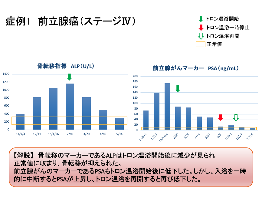 症例１　臨床データ　【解説】骨転移のマーカーであるALPはトロン温浴開始後に減少が見られ正常値に収まり、骨転移が抑えられた。前立腺癌マーカーであるPSAも温浴開始後に低下した。しかし、入浴を一時的に中断するとPSAが上昇し(赤矢印)、トロン温浴を再開すると再び低下した。